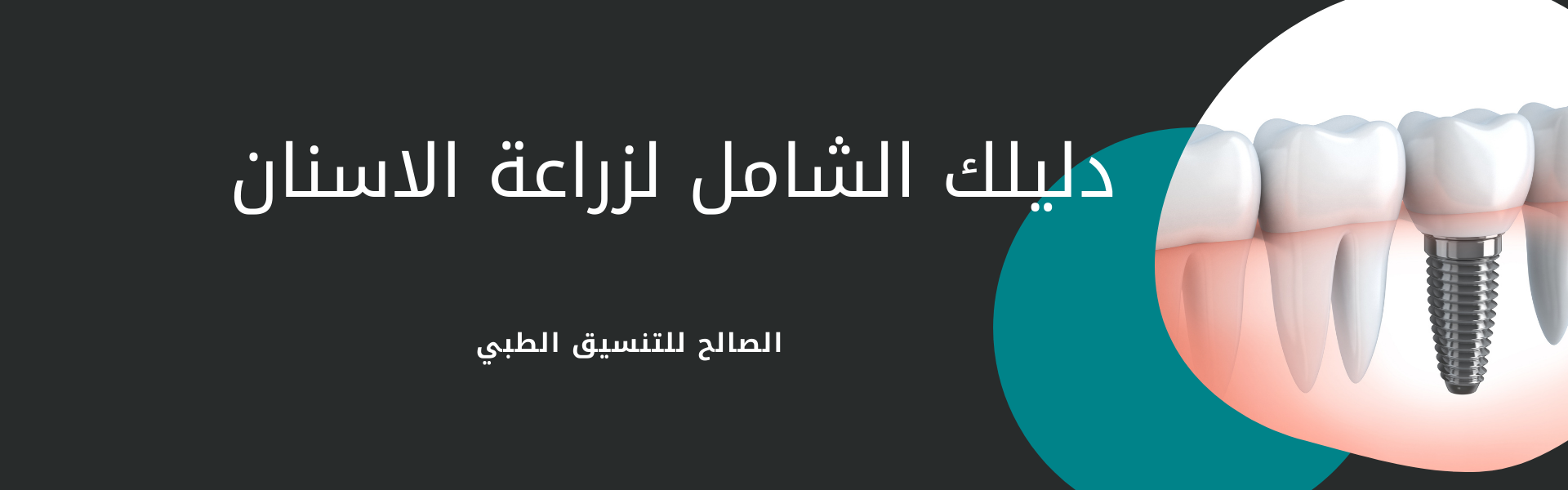 لماذا زراعة الاسنان في مسقط | السمات والتكاليف